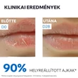 Kép 5/7 - Uriage Bariéderm ajakápoló balzsam (15ml)