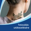 Kép 3/5 - Bepanthen kenőcs (30g)
