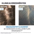 Kép 7/9 - Uriage D.S. Hair sampon korpás fejbőrre (200ml)