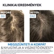 Kép 6/9 - Uriage D.S. Hair Intenzív sampon erősen korpás fejbőrre (150ml)