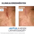 Kép 5/8 - Uriage Bariéderm Cica Cu-Zn sebkezelő krém (40ml)