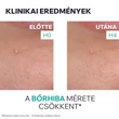 Kép 5/8 - Uriage Hyséac Szárító gél pattanások SOS kezelésére (15ml)