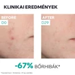 Kép 6/9 - Uriage Hyséac NEW SKIN BOOSTER Szérum bőrhibák ellen (30ml)