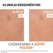 Kép 5/8 - Uriage Depiderm barna foltok elleni ragyogásr fokozó booster szérum (30ml)