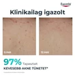Kép 5/8 - Eucerin Dermo Pure Clinical testkrém (200ml)