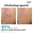 Kép 5/8 - Eucerin Dermo Pure Clinical bőrmegújító szérum (40ml)